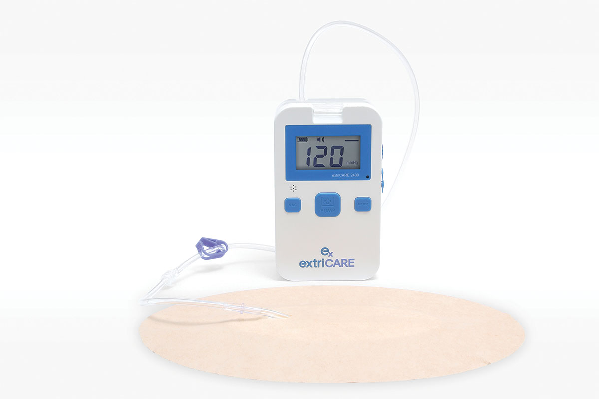Negative pressure wound therapy product application photo