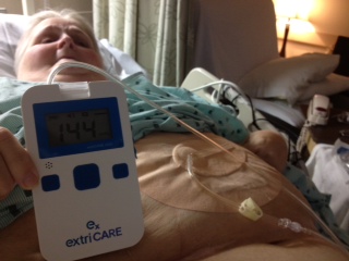 Negative pressure wound therapy pump, canister and dressing application photo