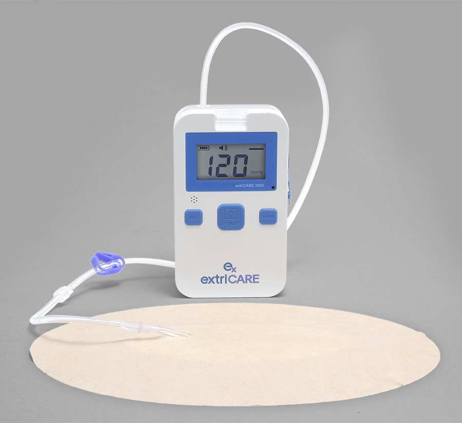 Negative pressure wound therapy pump, canister and dressing application photo