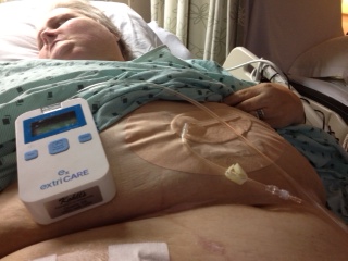 Negative pressure wound therapy pump, canister and dressing application photo